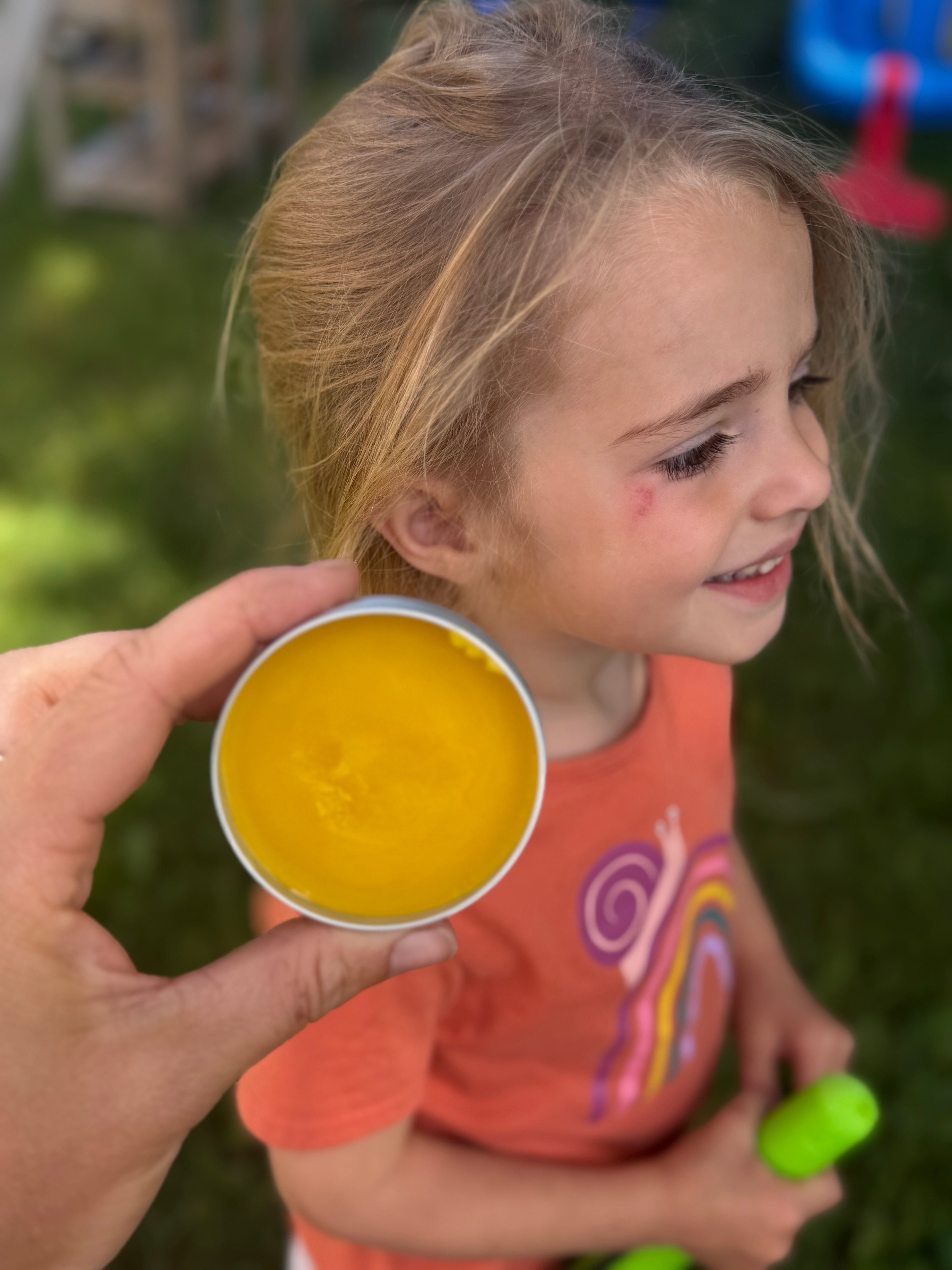 Parent holding dandelion balm to apply on child face and scrape