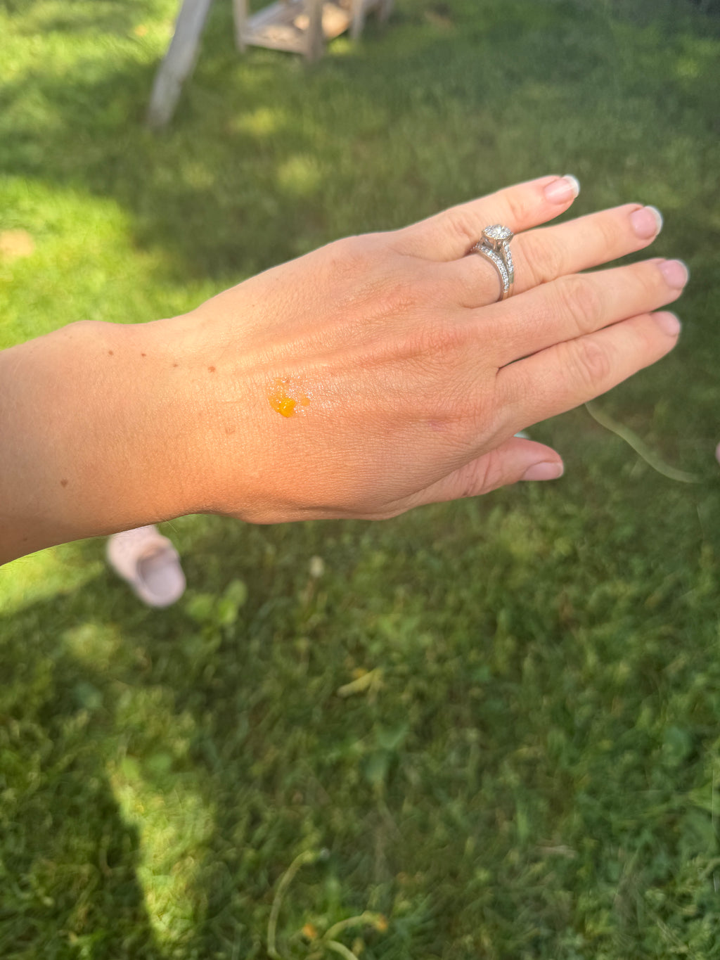 And with a ring with a dab of dandelion salve 