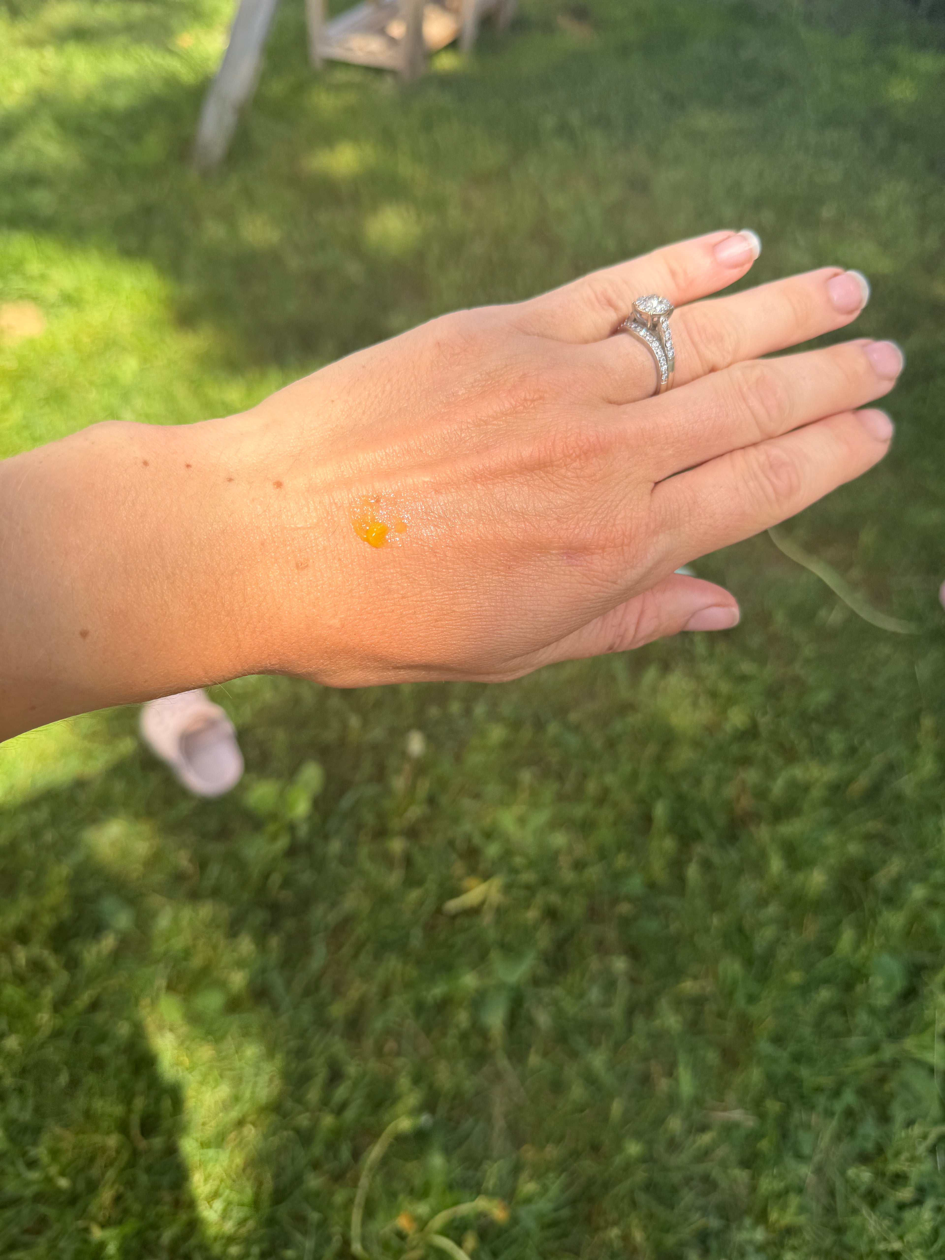 And with a ring with a dab of dandelion salve 